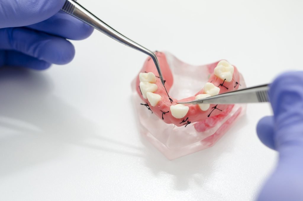 Suturing practice using a dental model