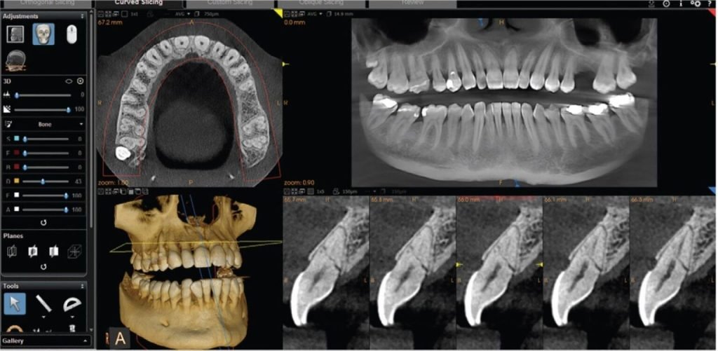 Panoramic, cross-sectional and three-dimensional dental images