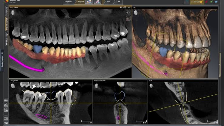 Dental imaging software displaying jaw anatomy in two and three dimensions