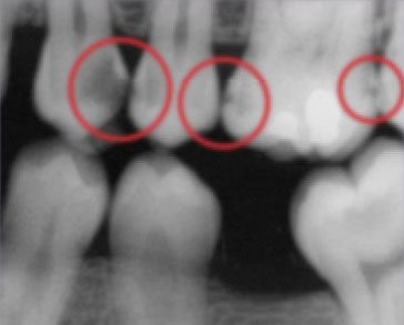 Dental radiograph with marked areas for discussion