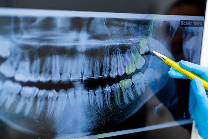 A panoramic dental radiograph being examined