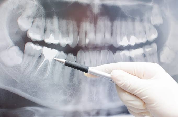 Reviewing tooth structures on a panoramic radiograph