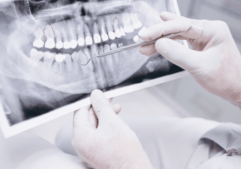 Dental instruments pointing to features on a radiograph