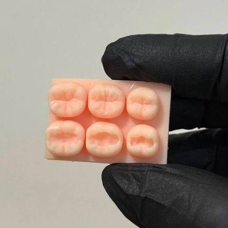 Dental models showing prepared and restored tooth surfaces