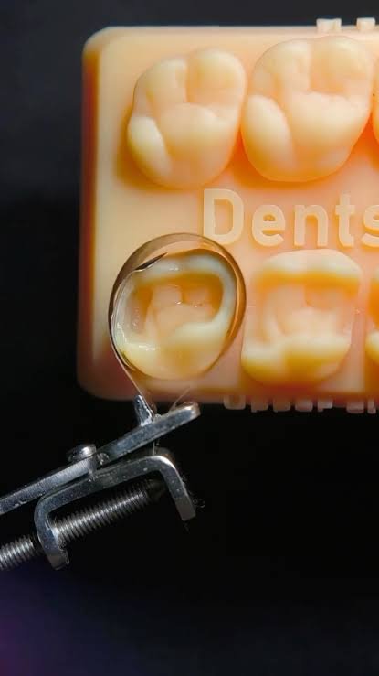 Restorative practice model with a matrix band around a tooth